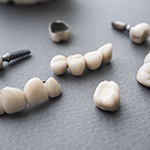 Implant crowns and bridges before placement