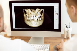 3D oral structures
