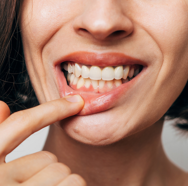 Woman pointing to her gums before gum disease treatment in Sparks