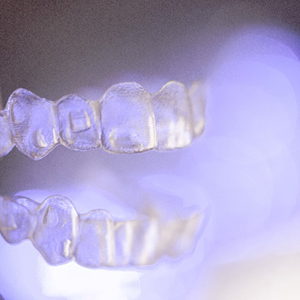 Invisalign | clear braces | Dr. Marc Thomas