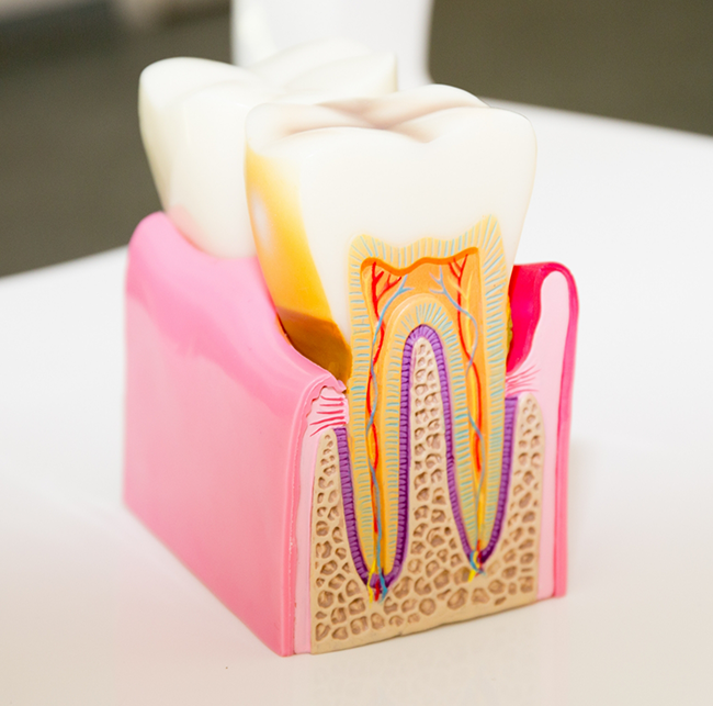 Model of a tooth showing the layers inside of it